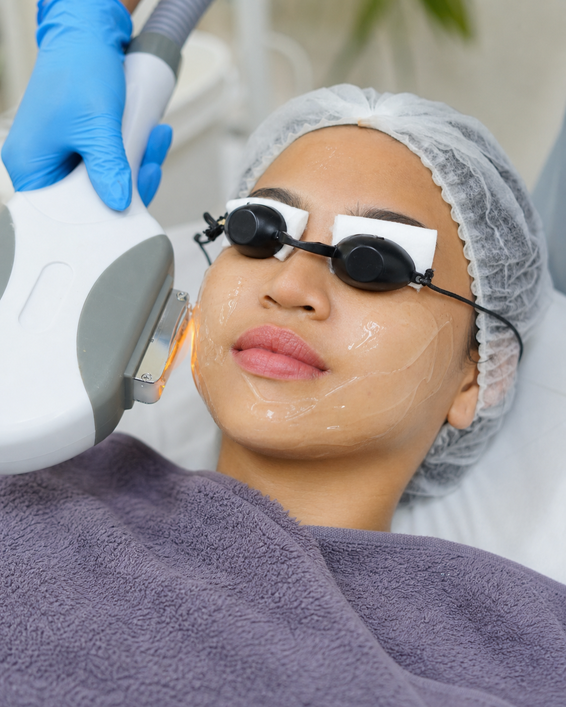 Foto treatment Hifu di MALVE Clinic